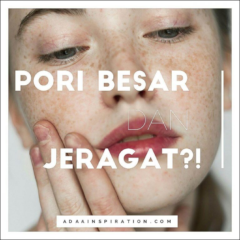 Masalah Pori Besar Dan Jeragat Kini Tiada Lagi!