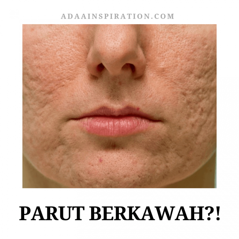 Parut Berkawah, Bolehkah Dipulihkan?